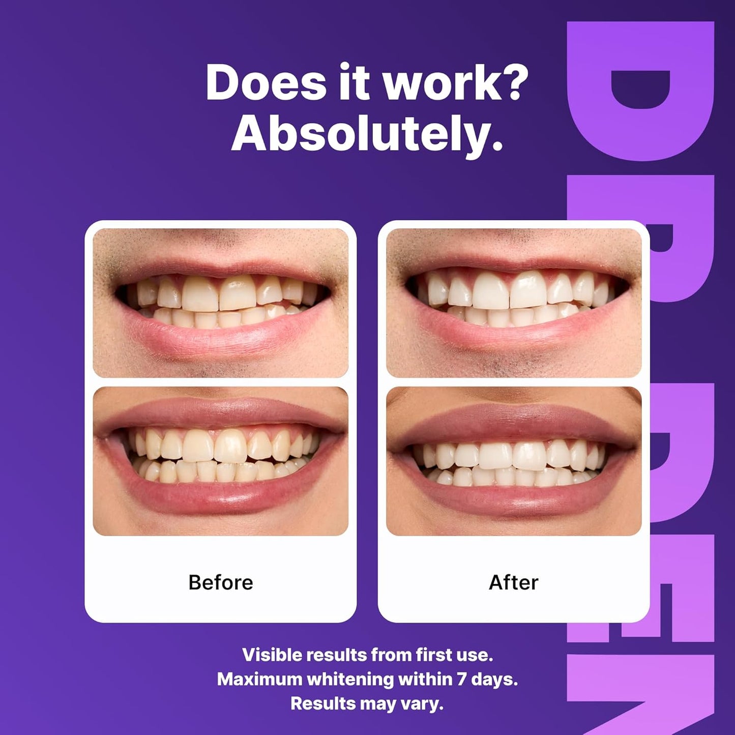 DRDENT Purple Teeth Whitening Strips 21 Treatments - Safe for Enamel - Non Sensitive Teeth Whitening - Whitening Without Any Harm - Pack of 42